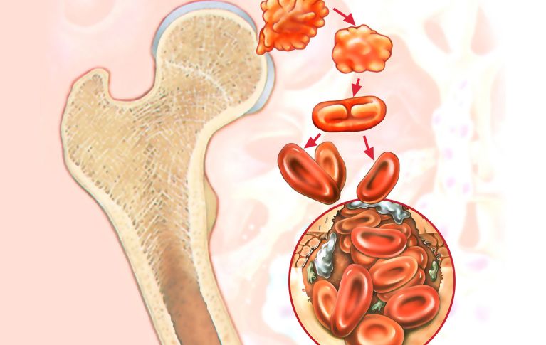 Schematische Darstellung von Knochenmark und wie sich aus den Blutstammzellen Blutzellen bilden