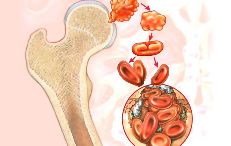 Rappresentazione schematica del midollo osseo e del modo in cui le cellule staminali del sangue formano le cellule ematiche